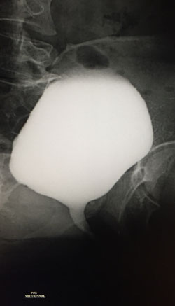 Cystographie