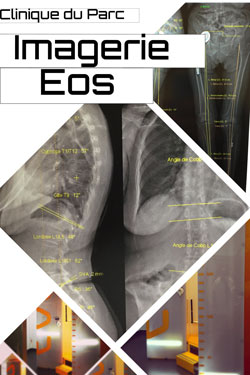 Imagerie EOS Clinique du Parc